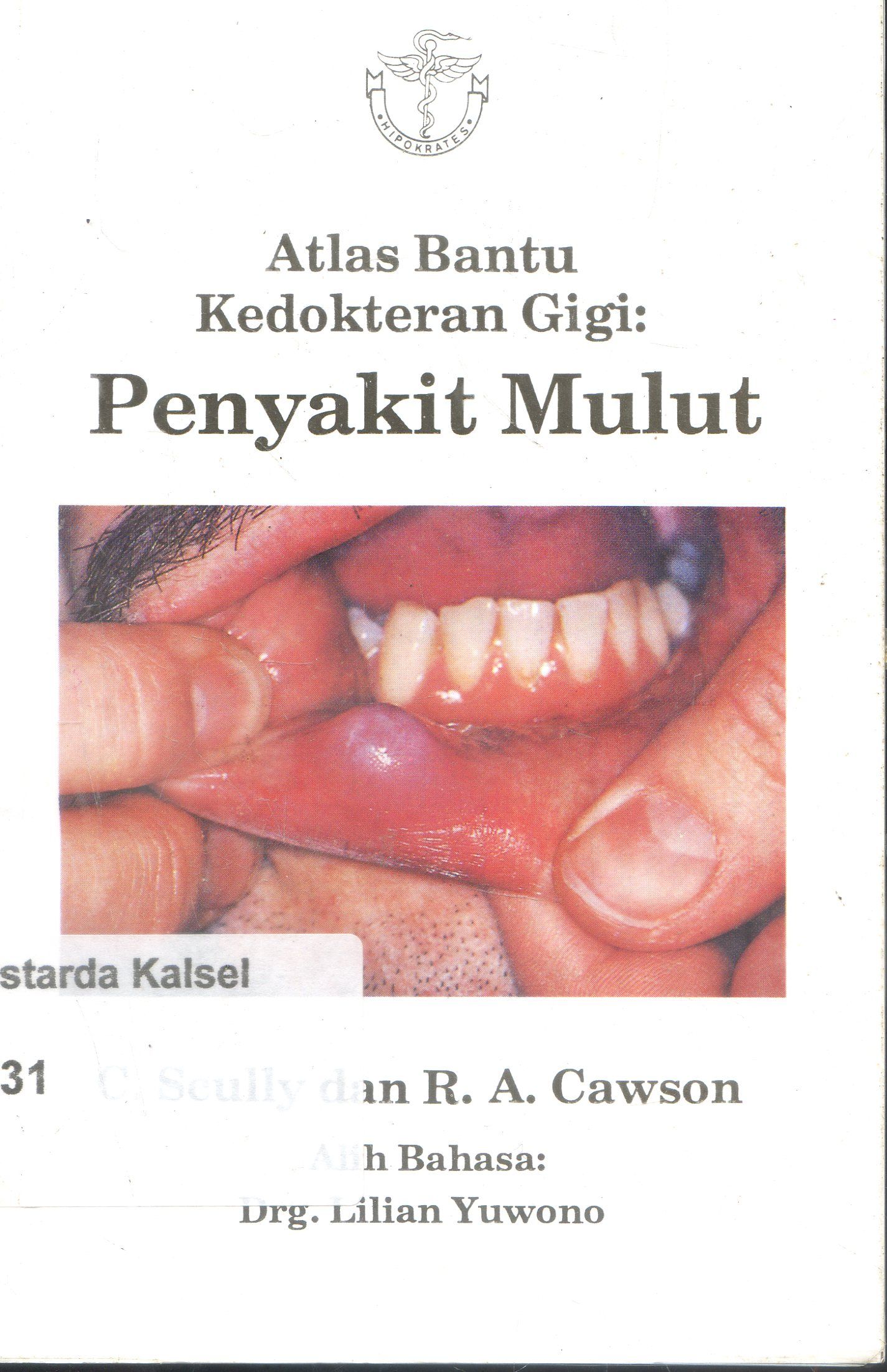 Cover Atlas Bantu Kedokter Gigi : Penyakit Mulut / C Scully ;Editor ,Lilian juwono