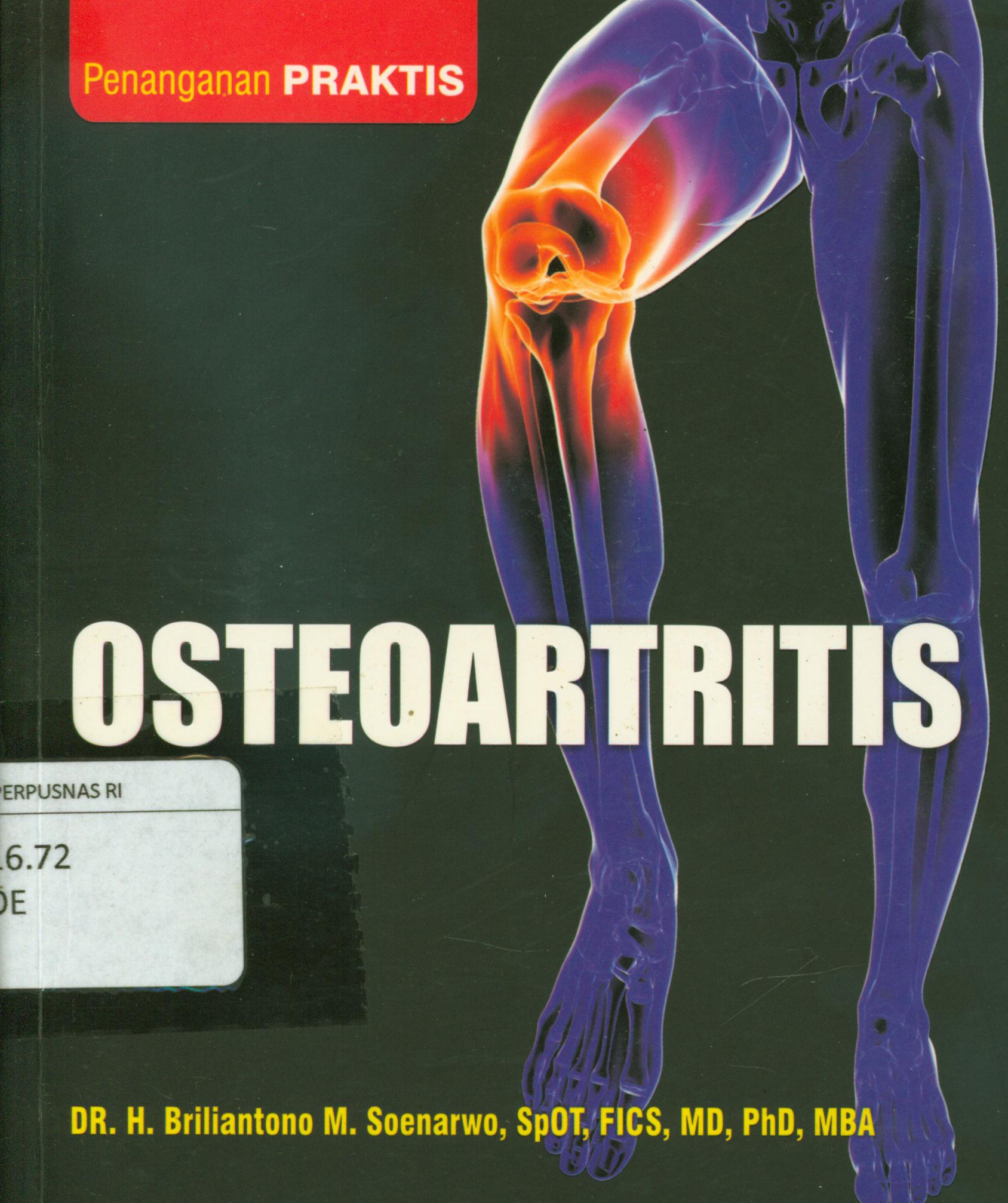 Cover Osteoartritis / Briliantono M. Soenarwo ; editor, Dwi Bagus, Tim Al-Mawardi Prima