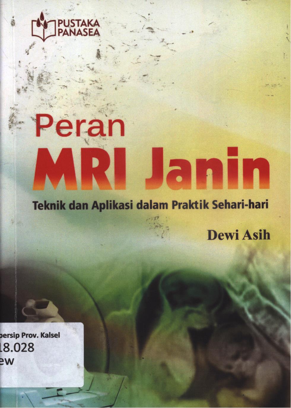 Cover Peran MRI janin :  Teknik dan aplikasi dalam praktik sehari-hari / Dewi Asih